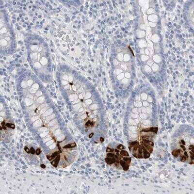 Immunohistochemistry-Paraffin: ABHD12 Antibody [NBP1-89308]