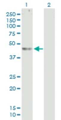 Western Blot: ABHD12 Antibody [H00026090-B01P]