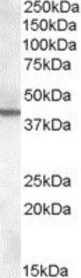 Western Blot: ABHD12 Antibody [NBP1-20875]