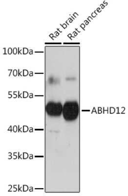 Western Blot: ABHD12 AntibodyAzide and BSA Free [NBP3-15549]