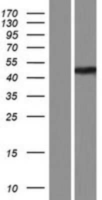 Western Blot: ABHD12 Overexpression Lysate [NBP2-08371]