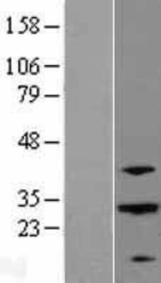 Western Blot: ABHD12B Overexpression Lysate [NBL1-07191]