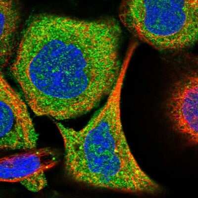 Immunocytochemistry/ Immunofluorescence: ABHD13 Antibody [NBP2-38205]