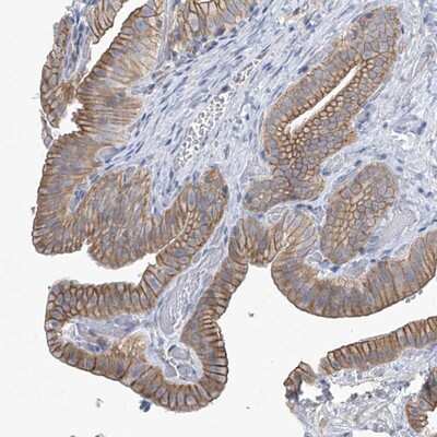 Immunohistochemistry-Paraffin: ABHD13 Antibody [NBP1-88978]