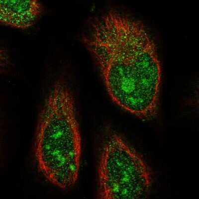 Immunocytochemistry/ Immunofluorescence: ABHD14B Antibody [NBP1-84472]