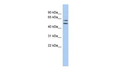 Western Blot: ABHD15 Antibody [NBP2-82547]