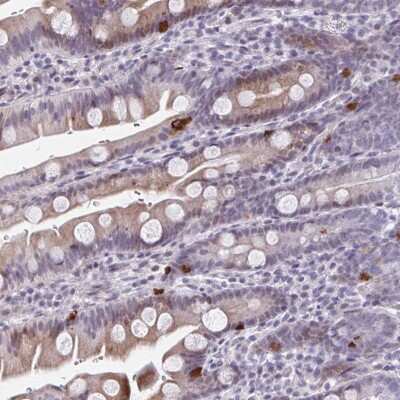Immunohistochemistry-Paraffin: ABHD16B Antibody [NBP2-31761]