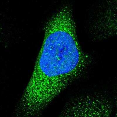 Immunocytochemistry/ Immunofluorescence: ABHD3 Antibody [NBP1-81327]
