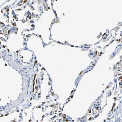 Immunohistochemistry-Paraffin: ABHD3 Antibody [NBP1-81327]
