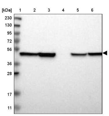 Western Blot: ABHD3 Antibody [NBP1-81327]
