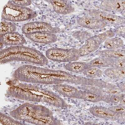 Immunohistochemistry-Paraffin: ABHD8 Antibody [NBP1-83728]