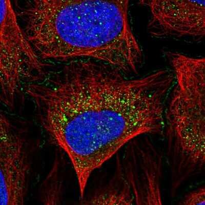 Immunocytochemistry/ Immunofluorescence: ABI1 Antibody [NBP2-56144]