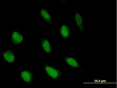 Immunocytochemistry/ Immunofluorescence: ABI2 Antibody [H00010152-B01P]