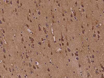 Immunohistochemistry-Paraffin: ABI2 Antibody [NBP2-98107]