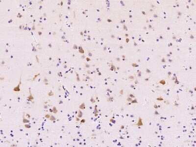 Immunohistochemistry-Paraffin: ABI2 Antibody [NBP2-99345]