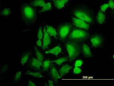 Immunocytochemistry/ Immunofluorescence: ABL2 Antibody (5C6) [H00000027-M09]