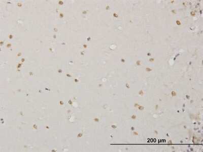Immunohistochemistry-Paraffin: ABL2 Antibody (5C6) [H00000027-M09]