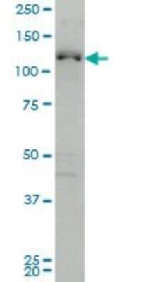 Western Blot: ABL2 Antibody (6D5) [H00000027-M03]