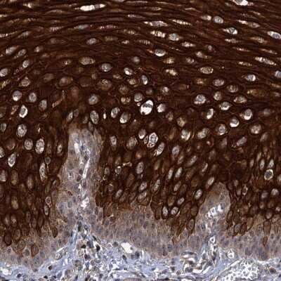 Immunohistochemistry-Paraffin: ABLIM1 Antibody [NBP1-89303]