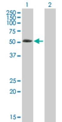 Western Blot: ABLIM3 Antibody [H00022885-B01P]