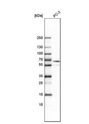Western Blot: ABLIM3 Antibody [NBP1-81471]