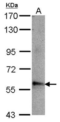 Western Blot: ABLIM3 Antibody [NBP2-15231]