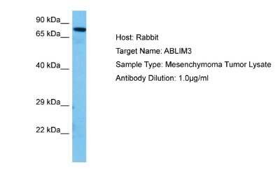 Western Blot: ABLIM3 Antibody [NBP2-86781]
