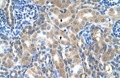 Immunohistochemistry-Paraffin: ABP1/AOC1 Antibody [NBP1-58006]