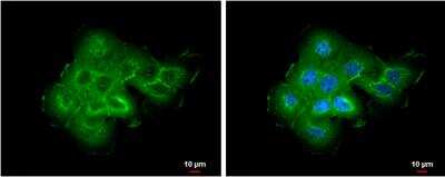 Immunocytochemistry/ Immunofluorescence: ABR Antibody [NBP1-30981]
