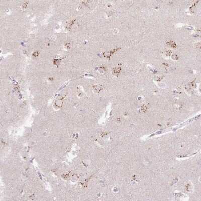 Immunohistochemistry-Paraffin: ABR Antibody [NBP2-49152]