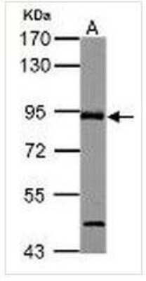 Western Blot: ABR Antibody [NBP1-30981]
