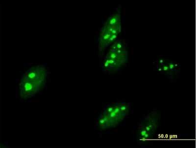 Immunocytochemistry/ Immunofluorescence: ABT1 Antibody [H00029777-B01P]