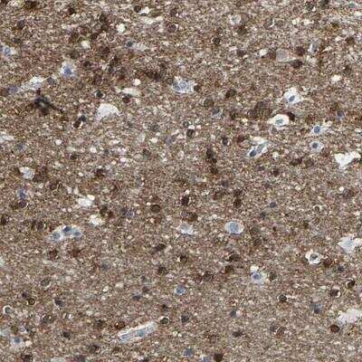 Immunohistochemistry-Paraffin: ABTB2 Antibody [NBP1-84141]