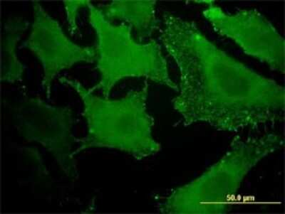 Immunocytochemistry/ Immunofluorescence: ACAA1 Antibody (3F11) [H00000030-M01]