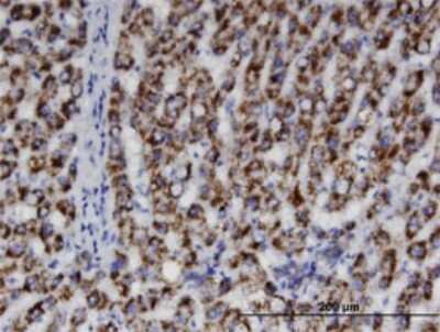 Immunohistochemistry-Paraffin: ACAA1 Antibody (3F11) [H00000030-M01]
