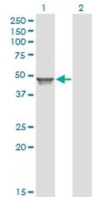 Western Blot: ACAA1 Antibody (3F11) [H00000030-M01]