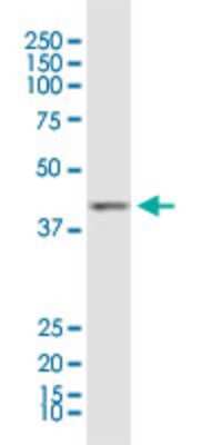 Western Blot: ACAA1 Antibody (3F11) [H00000030-M01]