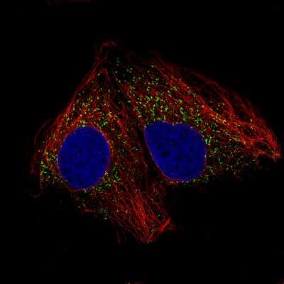 Immunocytochemistry/ Immunofluorescence: ACAA1 Antibody (CL2650) [NBP2-42380]