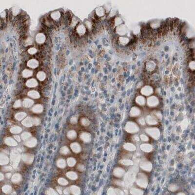 Immunohistochemistry: ACAA1 Antibody (CL2650) [NBP2-42380]