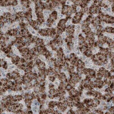 Immunohistochemistry: ACAA1 Antibody (CL2650) [NBP2-42380]