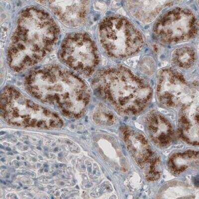 Immunohistochemistry: ACAA1 Antibody (CL2650) [NBP2-42380]