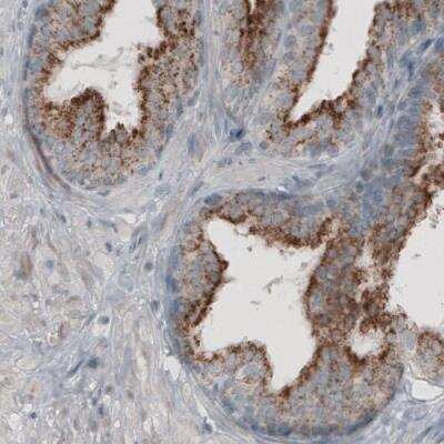 Immunohistochemistry: ACAA1 Antibody (CL2650) [NBP2-42380]
