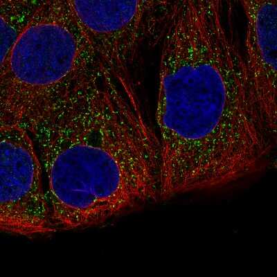 Immunocytochemistry/ Immunofluorescence: ACAA1 Antibody (CL2660) [NBP2-42383]