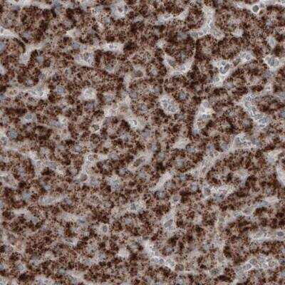 Immunohistochemistry: ACAA1 Antibody (CL2660) [NBP2-42383]