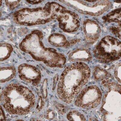 Immunohistochemistry: ACAA1 Antibody (CL2660) [NBP2-42383]