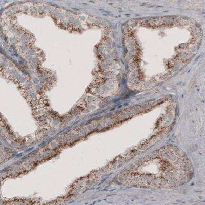 Immunohistochemistry: ACAA1 Antibody (CL2660) [NBP2-42383]
