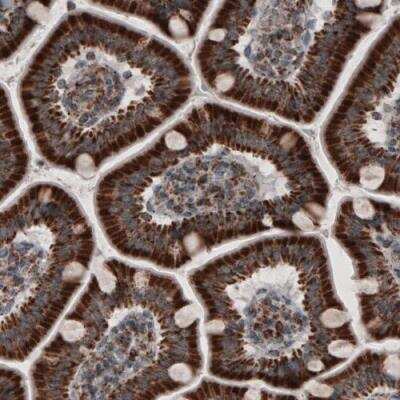 Immunohistochemistry: ACAA1 Antibody (CL2660) [NBP2-42383]