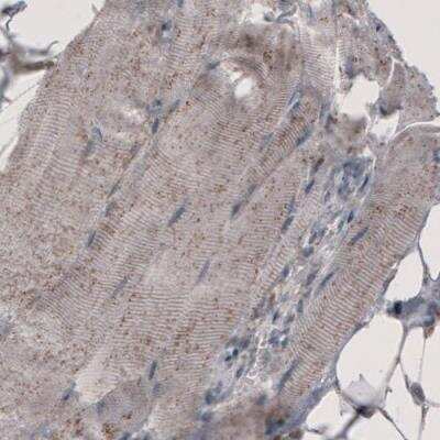 Immunohistochemistry: ACAA1 Antibody (CL2660) [NBP2-42383]