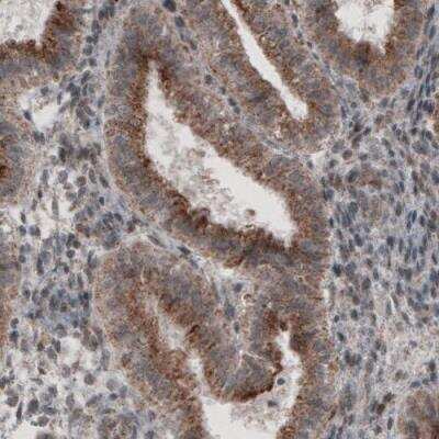 Immunohistochemistry: ACAA1 Antibody (CL2662) [NBP2-42381]