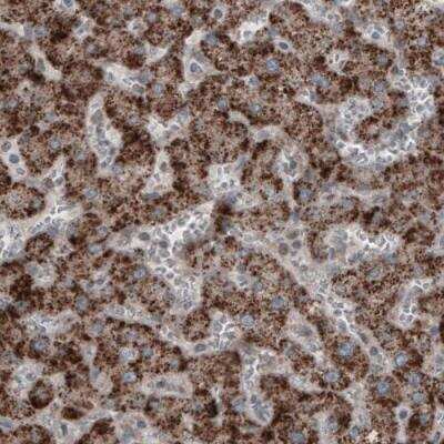 Immunohistochemistry: ACAA1 Antibody (CL2663) [NBP2-42382]
